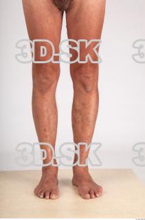 Leg texture of Augustyn 0002